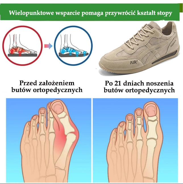 🔥 50% zniżki | buty ortopedyczne flemat® | Zapewniają wsparcie łuku stopy, łagodzą ból i ułatwiają chodzenie | Odpowiednie zarówno dla mężczyzn, jak i kobiet.