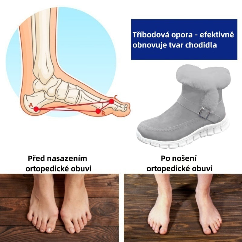 flemat® - Ergonomicznie ukształtowane zimowe buty ortopedyczne łagodzące ból stóp, kolan i pleców - Damskie