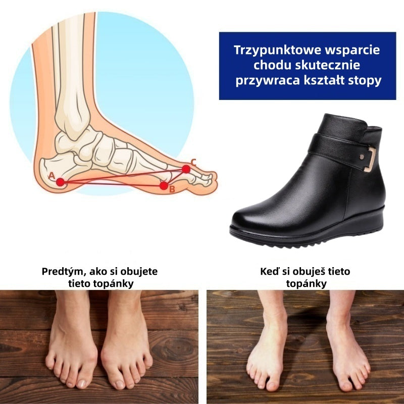 🔥 50% zniżki dzisiaj - Nie przegap ⏰ - Miękkie i wygodne damskie buty z prawdziwej skóry owczej (z podparciem łuku stopy dla łatwiejszego chodzenia)