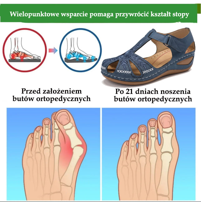 Ergonomiczne sandały ortopedyczne — z podparciem łuku stopy, które pomaga złagodzić ból stóp, ustabilizować piętę i zmniejszyć niestabilność podczas chodzenia